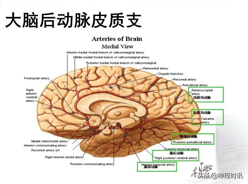 脑动脉解剖学讲解,基底节区脑血管解剖