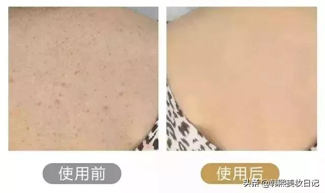 洗澡搓不到后背怎么办,洗澡怎么搓后背