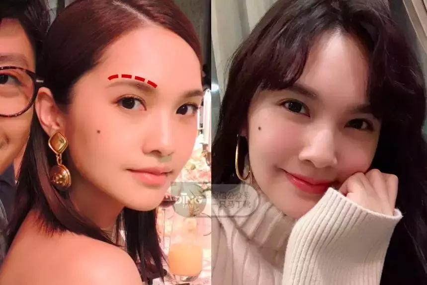 张雨绮杨丞琳对比,张雨绮眼型分析