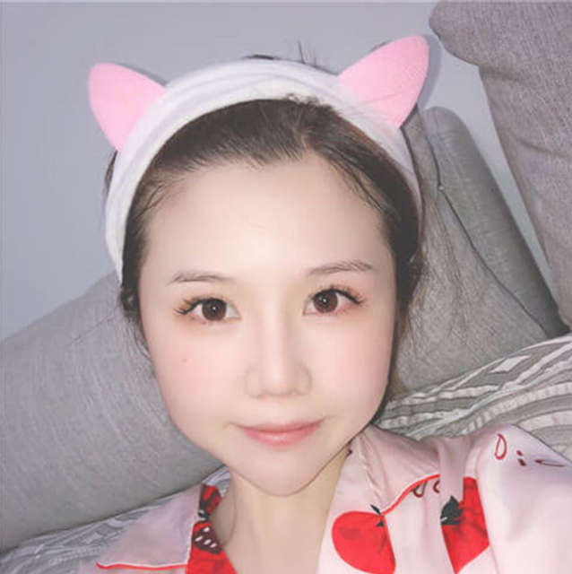 面部毛孔粗大如何改善,面部毛孔粗大怎么办如何改善