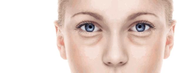 眼袋怎么消除简单方法男生,黑眼袋怎么消除最快方法男士