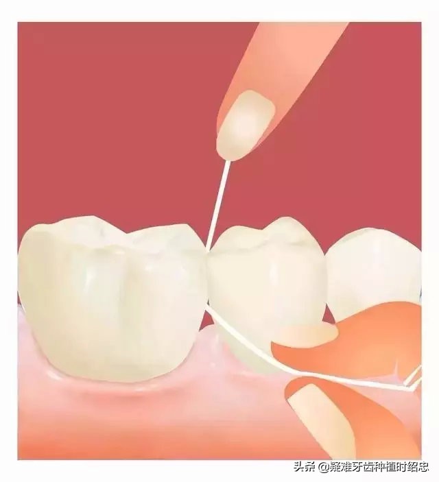 牙缝大是福是祸,牙缝宽什么命运