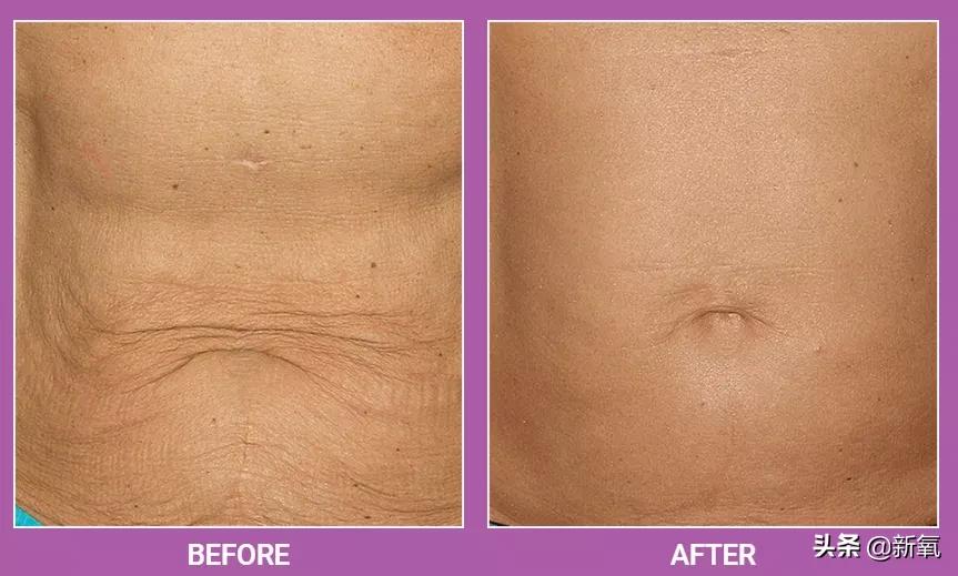 很多人夸赵丽颖,赵丽颖都被谁夸过