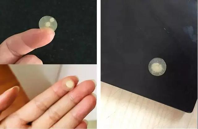 痘坑痘印修复的最佳方法片仔癀,片仔癀抗痘修复贴