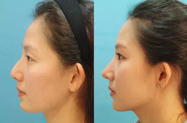 鼻子有这4个特征的人，才称得上“美鼻”，让人眼睛都挪不开