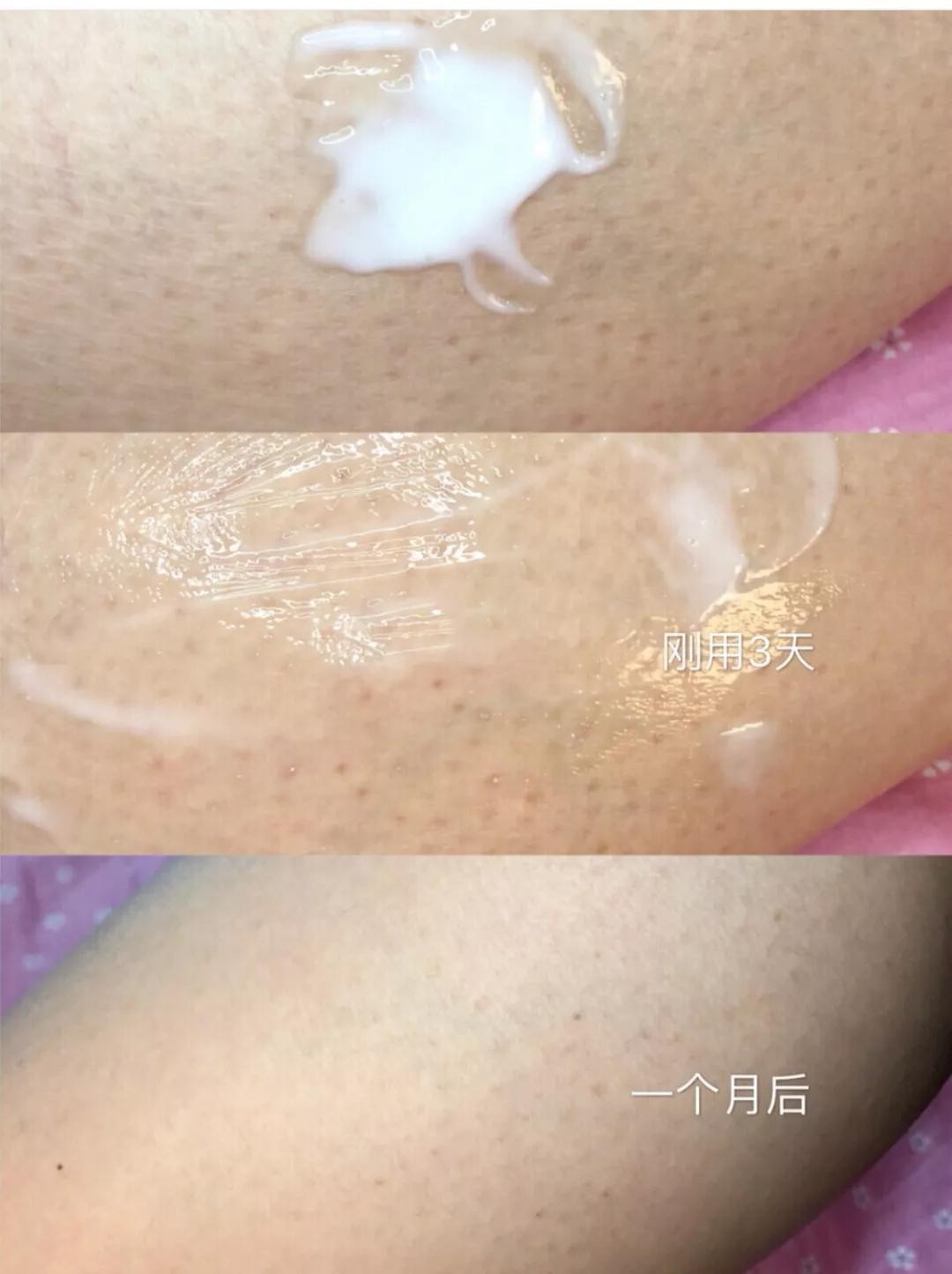 get何穗同款牛奶肌！秋冬去鸡皮，黑黄皮必入