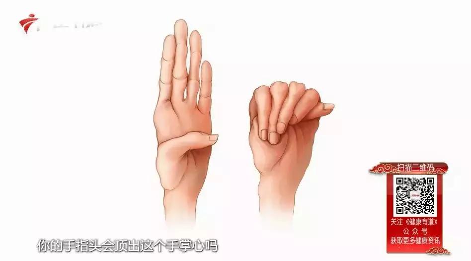 主动脉夹层手术后会猝死吗,主动脉夹层破裂猝死有救吗