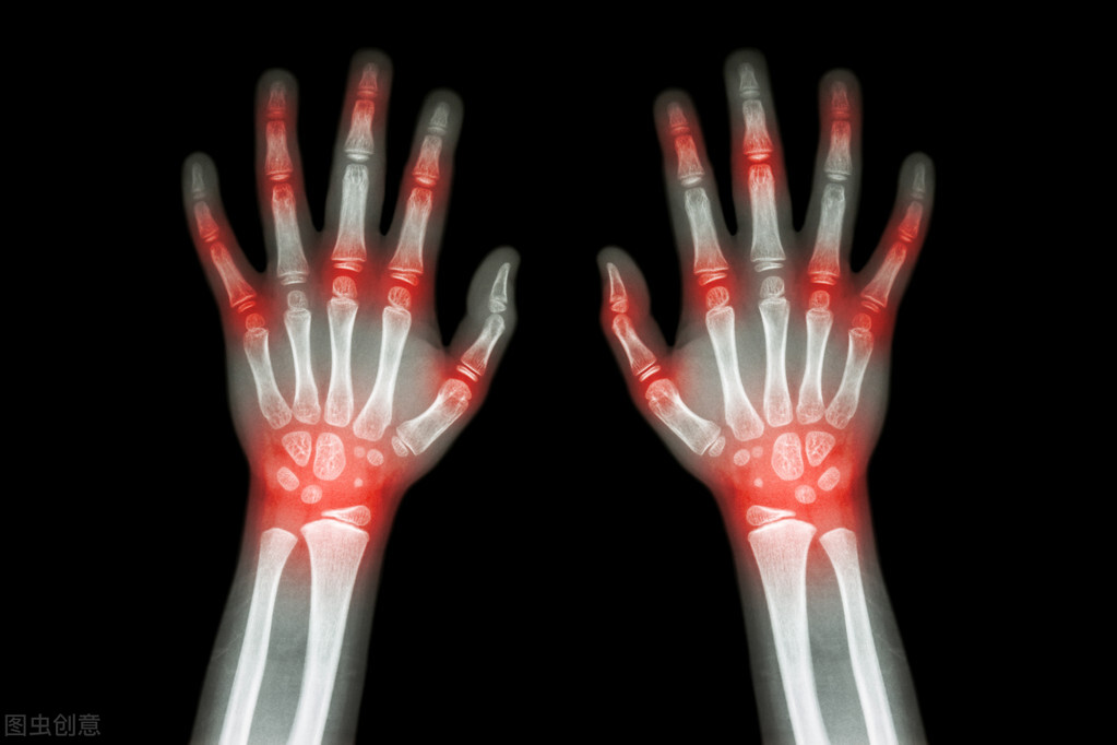 三孩生育政策来了，育龄期妇女如何预防产后风湿？