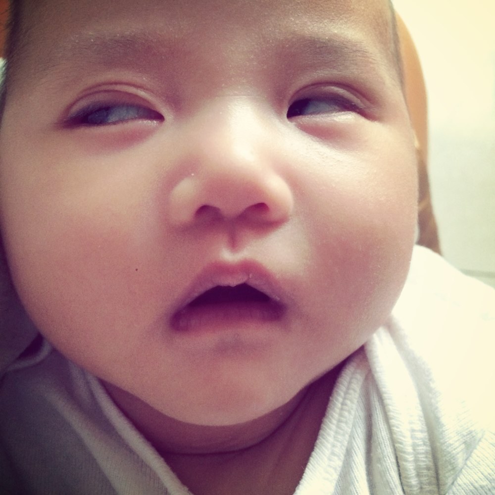 小孩发烧惊厥抽搐翻白眼面色发紫,高烧惊厥抽搐吐白沫翻白眼