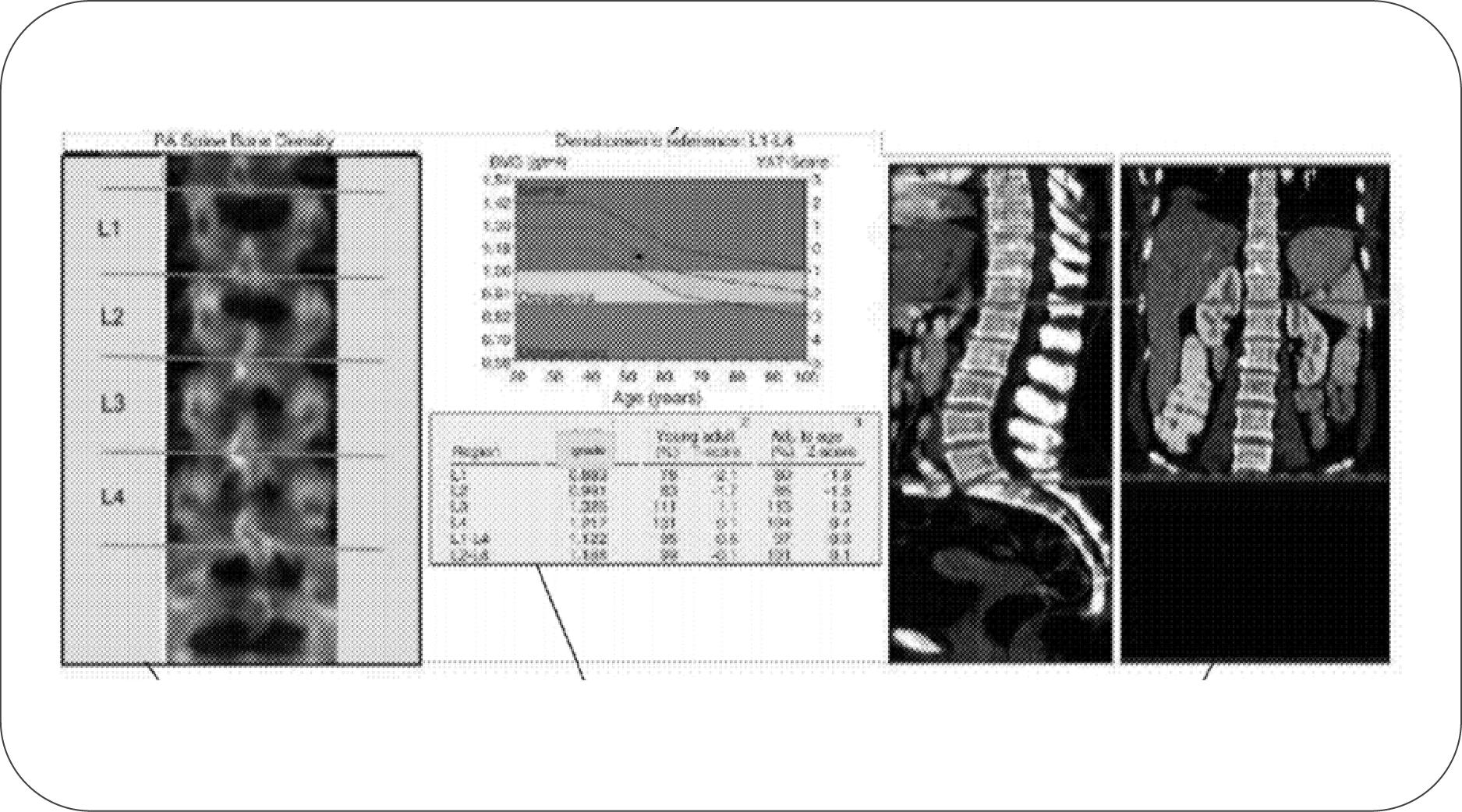 ai取代影像医生要多久,医学影像会被ai取代吗