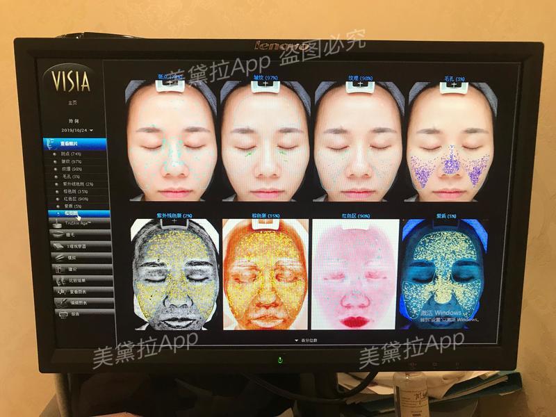 类人胶原蛋白能收缩毛孔么,胶原蛋白抗皱原液真实测评