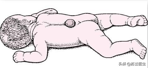 怀孕10周补充叶酸来得及吗,怀孕初期可以用爱乐维补充叶酸吗