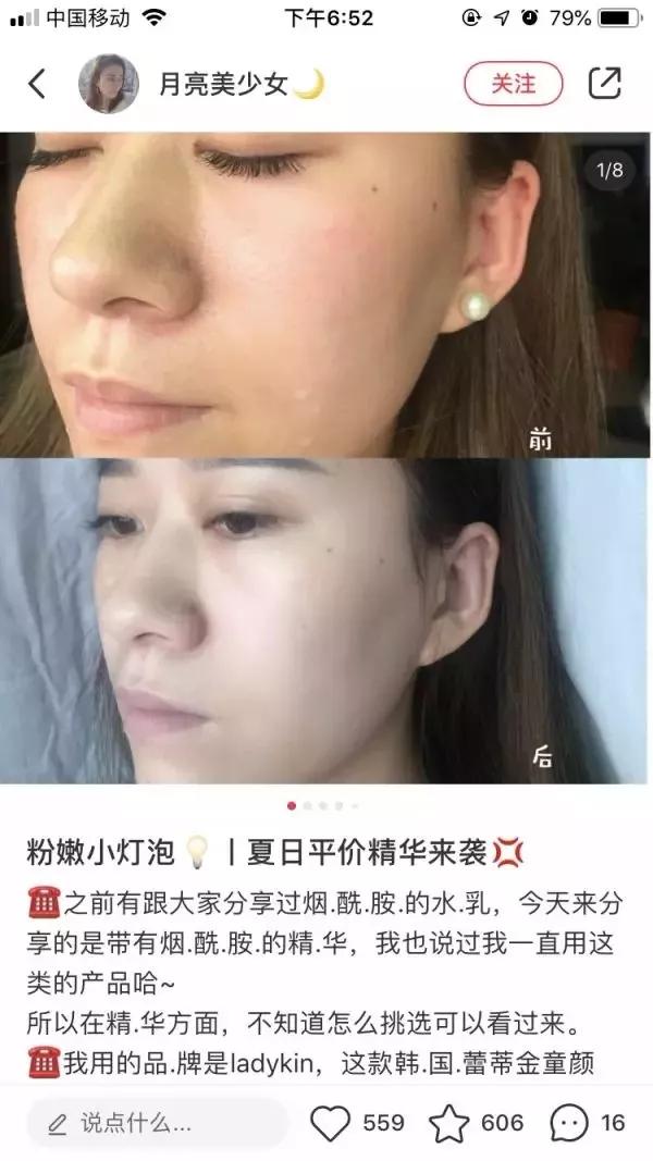 2块钱的它、竟然能亮白、祛痘印、淡斑！？太神奇了！