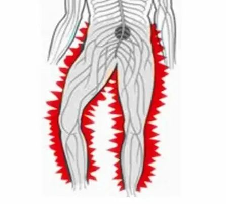 怎么辨别是不是癌引起的腰腿疼,什么癌症会导致腰腿痛