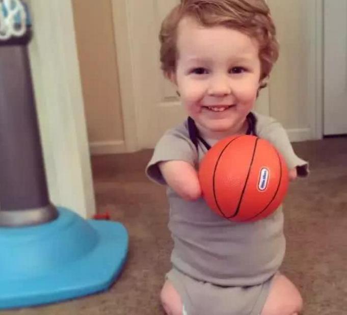 严重脑瘫神童,中国天才少年脑瘫