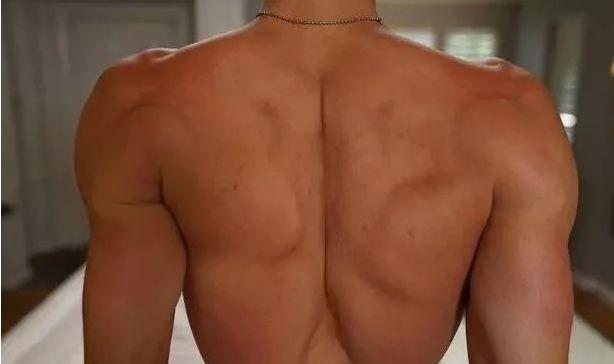 隆胸那些事你真的了解吗,隆胸加腹壁整形