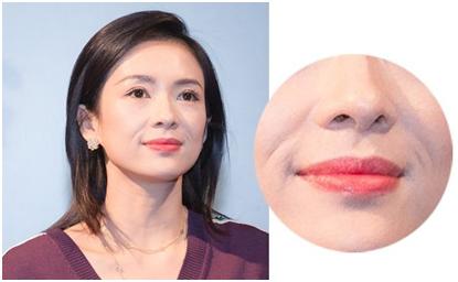 法令纹都是有什么方法可以去除,去法令纹最有效的办法明星