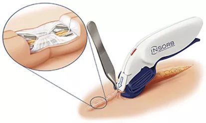 蚂蚁和蚂蚁之间是怎样沟通的呢,蚂蚁和米混在一起怎么拿出来