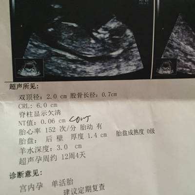 怀孕初期注意事项及产检报告指标,孕早期注意事项视频