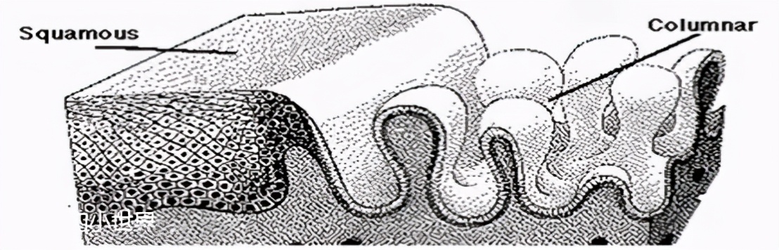 宫颈糜烂吃什么药可以快速治愈,女性宫颈糜烂是什么原因引起的