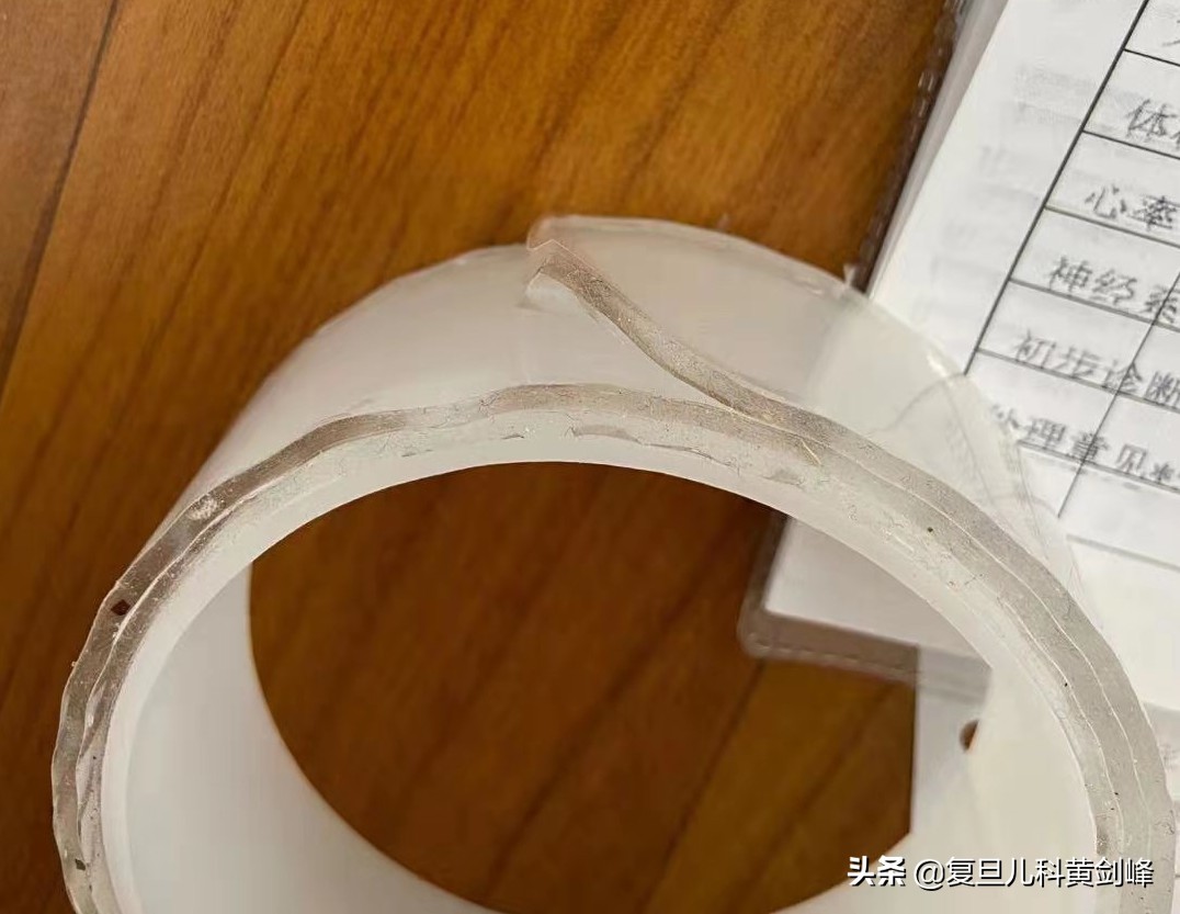 7岁女孩口臭是什么原因,七岁女孩口臭怎么回事