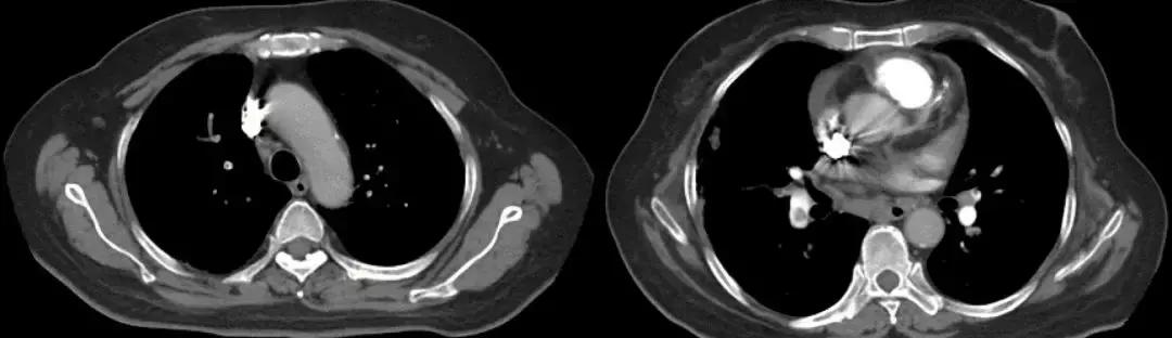 抗菌药物不合理处方分析,抗菌药物用药不合理的表现