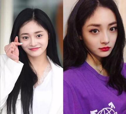 人中长颧骨高适合什么发型,人中长太阳穴凹陷