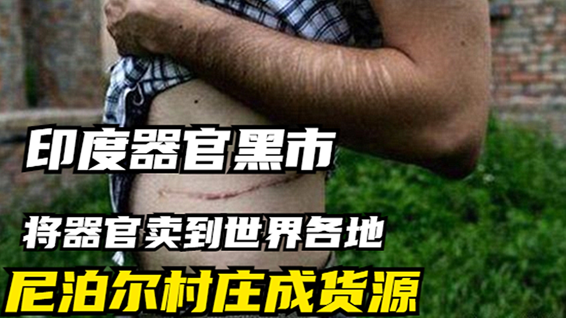 印度黑暗的器官交易：尼泊尔村庄成为肾谷，一个肾仅需1300美元