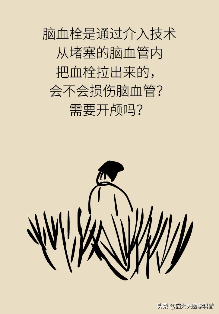 不手术能彻底治好血栓外痔吗,介入治血栓最好的方法