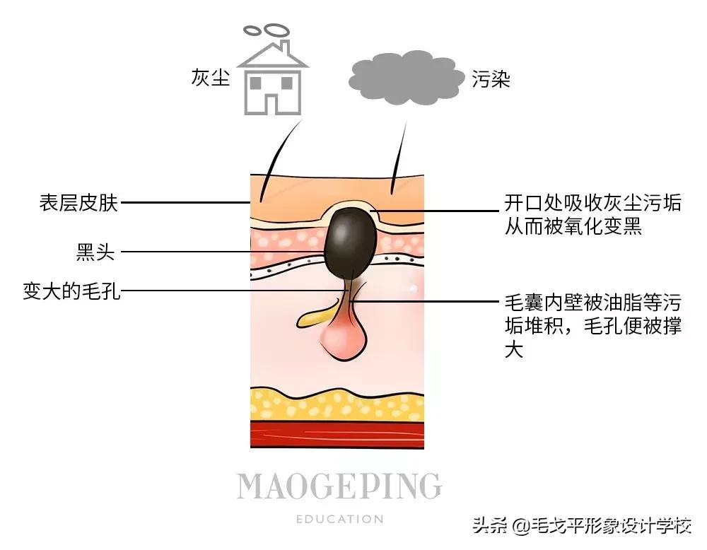 鹤叔十滴水去黑头方法,科颜氏白泥去黑头正确使用方法