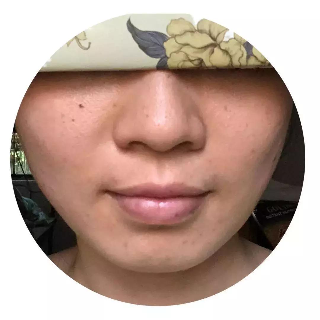 皮肤改造计划丨去痘印、美白、淡化眼部细纹，解决问题并不贵~