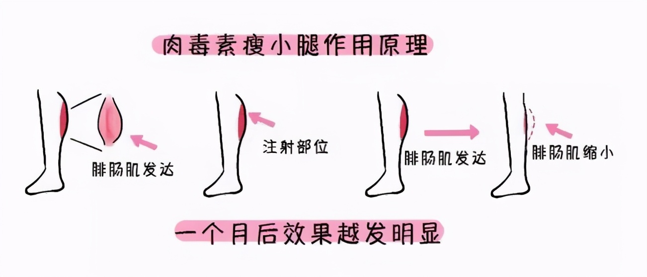 瘦腿霜会有用吗,瘦腿霜有用吗会反弹吗