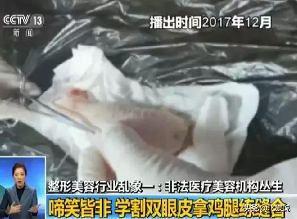 整形行业的现状,整形行业未来会淘汰吗