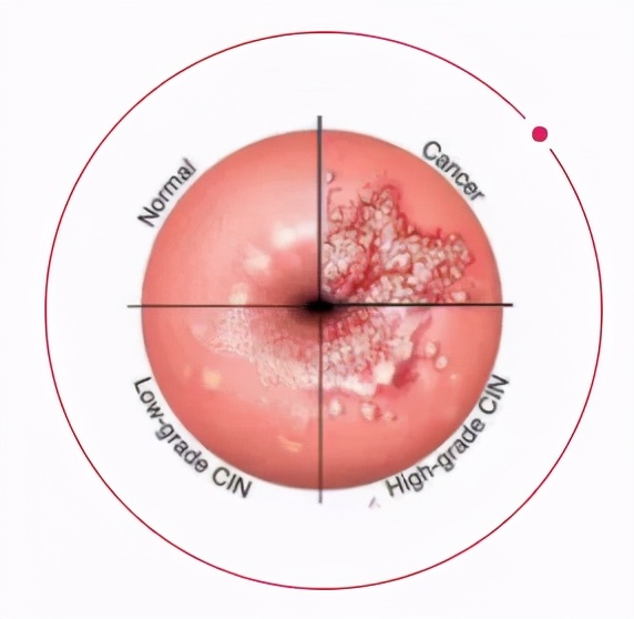 人流手术检查前要注意什么,人流手术前要做什么检查
