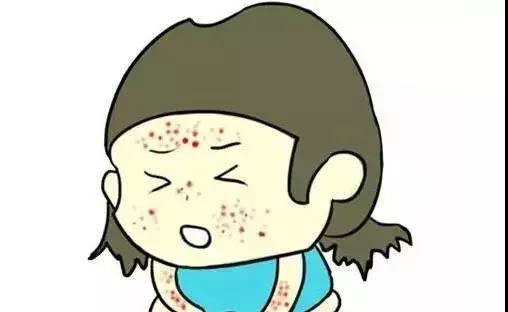 宝宝脸晒红了就是晒伤了吗,宝宝晒伤脸红了怎么快速恢复