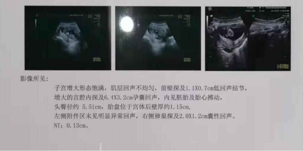 盲目追求“功课”时间长,菏泽小夫妻怀孕困难,来听听主任怎么讲