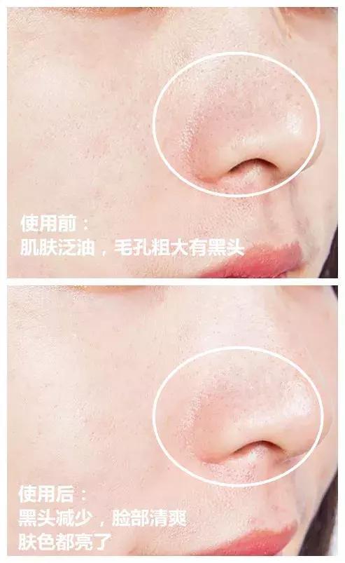 经常敷面膜有什么改善,经常敷面膜皮肤看起来还是很差