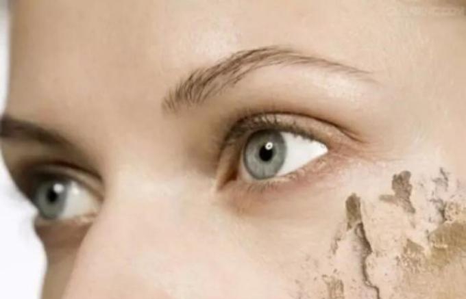 为什么我才三十岁就很多皱纹,为什么我20岁眼角就有细纹了