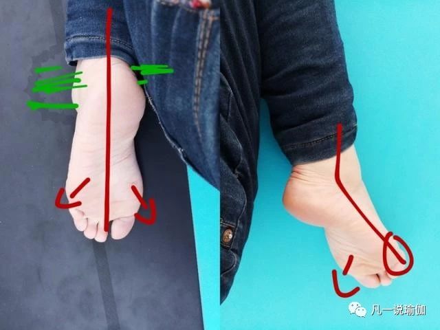 瑜伽中缓解膝盖疼方法,瑜伽坐角式膝盖疼怎么回事