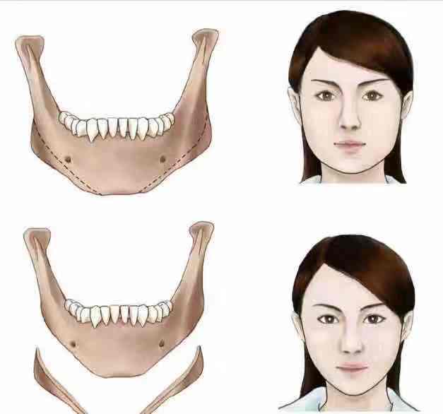 娣卞湷棰岄潰澶栫鏁村舰,娣卞湷鍙ｈ厰鍖婚櫌棰岄潰鏁村舰