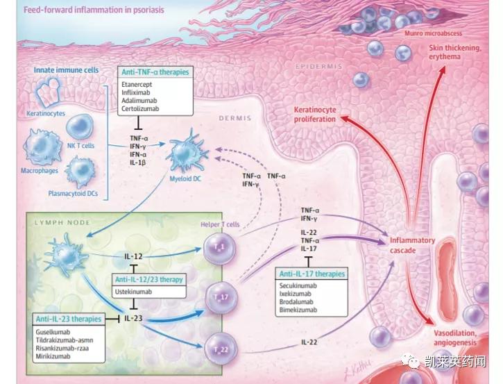目前治疗银屑病最好的生物制剂,全球最新银屑病新药