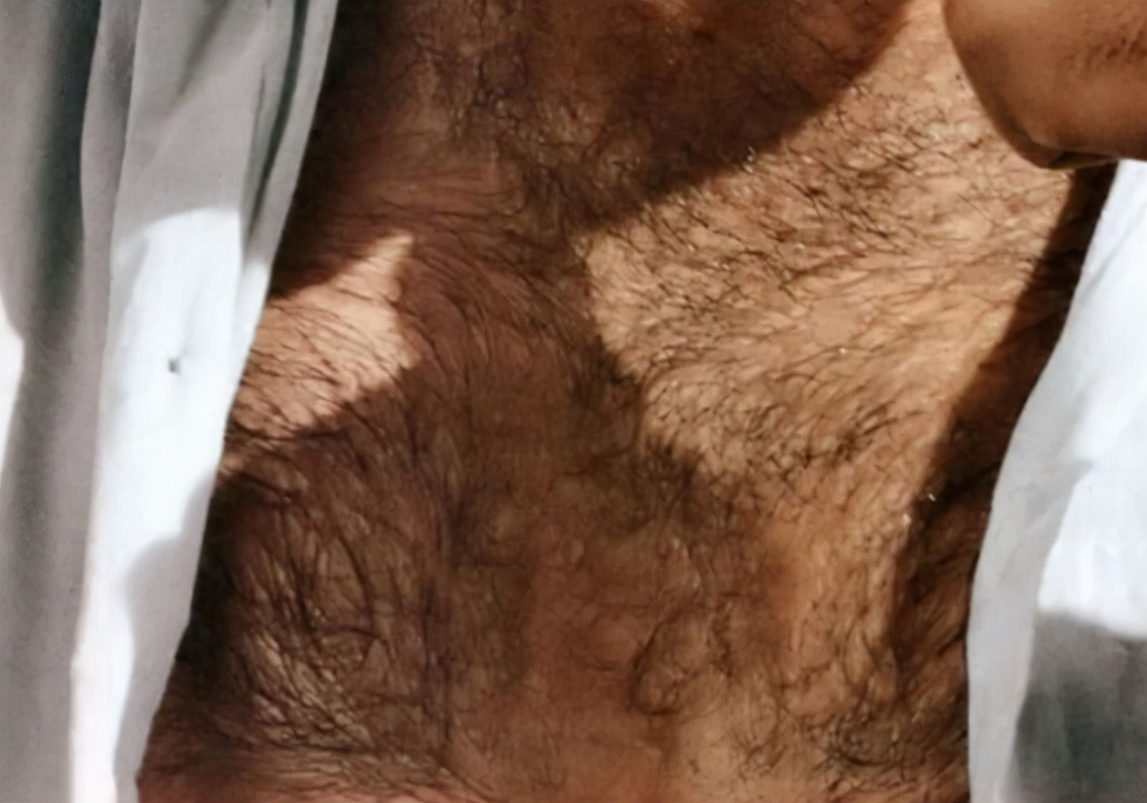 为什么有些男人胸部中间长痘,为什么男生胸部会长小毛毛