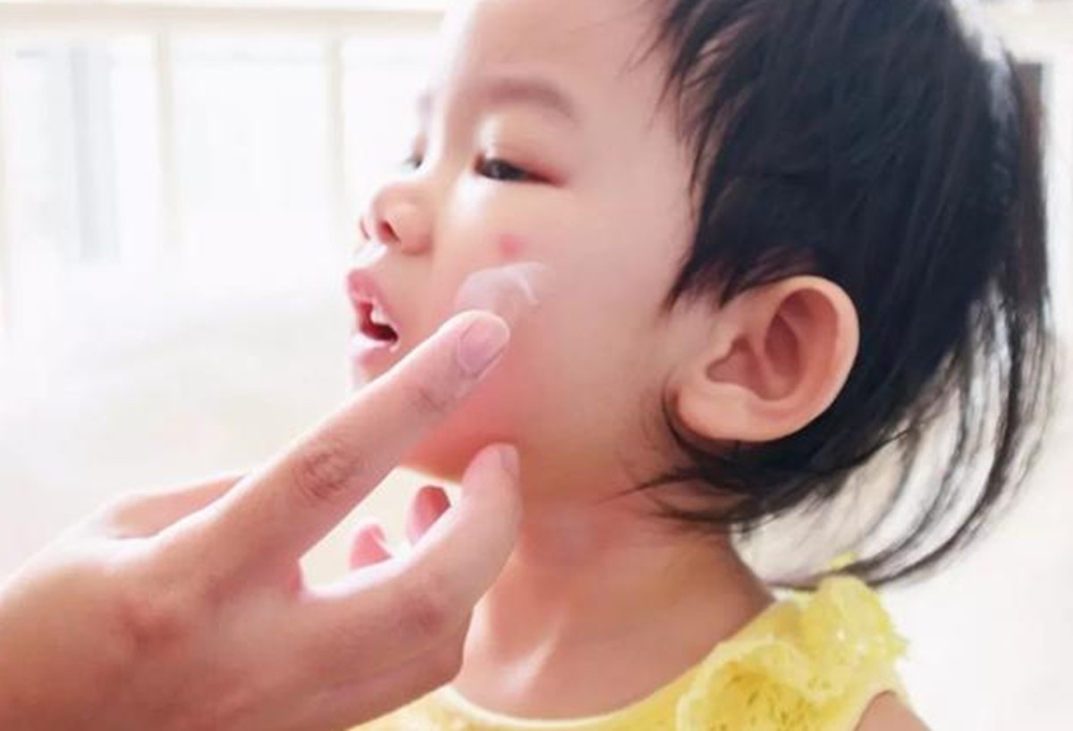 蚊子咬了宝宝能涂花露水吗,蚊子咬了宝宝的手可以涂花露水吗