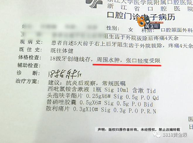 两次拔牙中间需要间隔多久,两次拔牙必须是一个医生吗