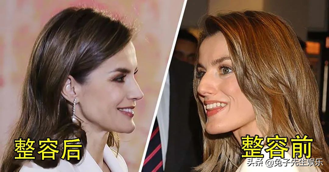 西班牙王妃整容,西班牙王后大方承认整形