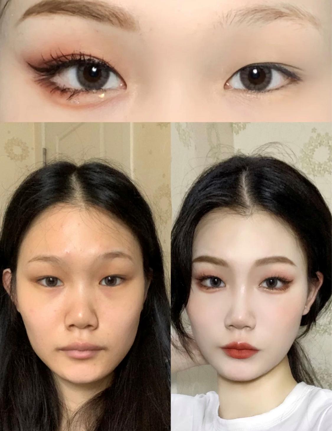 眼部消肿教程,眼部消肿最有效的方法