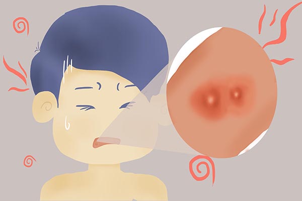 总是口腔溃疡试试这7个防治方法,天天口腔溃疡怎么回事呀