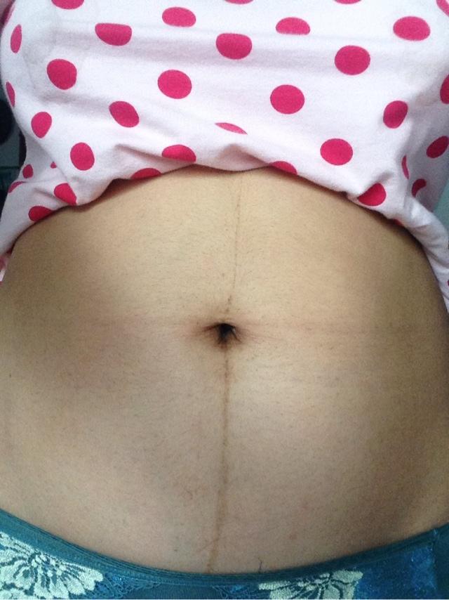 别人生完看不出，自己生完回不去，“产后易瘦体质”有哪些特征？