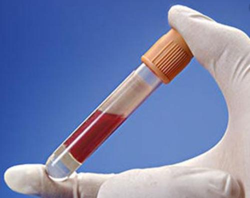 肾病好不好治疗,肾病严重不严重看肾小球滤过率吗