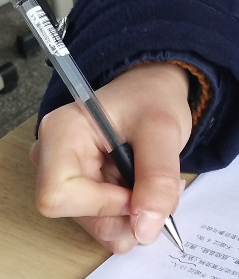 可怜的小手,冬天可怜的小手